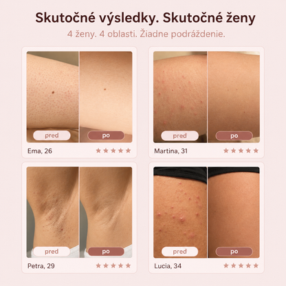 DERMAGLIDE: 2v1 Epilátor a Odstranovač Chlpkov